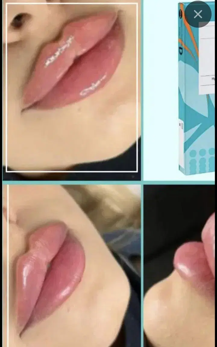 دعوت به همکاری مارکتینگ جراحی زیبایی بدن و صورت|استخدام درمانی، زیبایی، بهداشتی|تهران, آسمان|دیوار