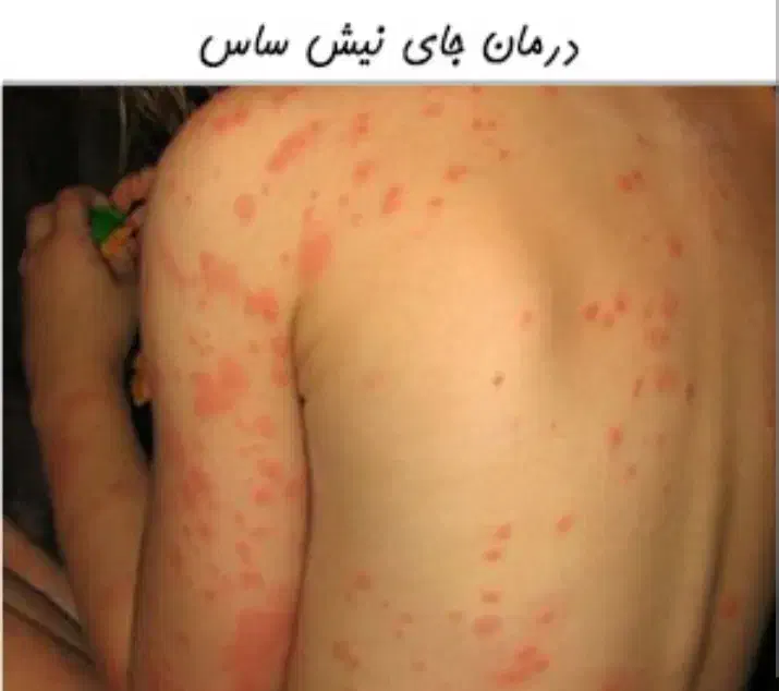خدمات سمپاشی %100تضمینی %100تضمینی تمام نقاط تهران|خدمات نظافت|تهران, پاسداران|دیوار