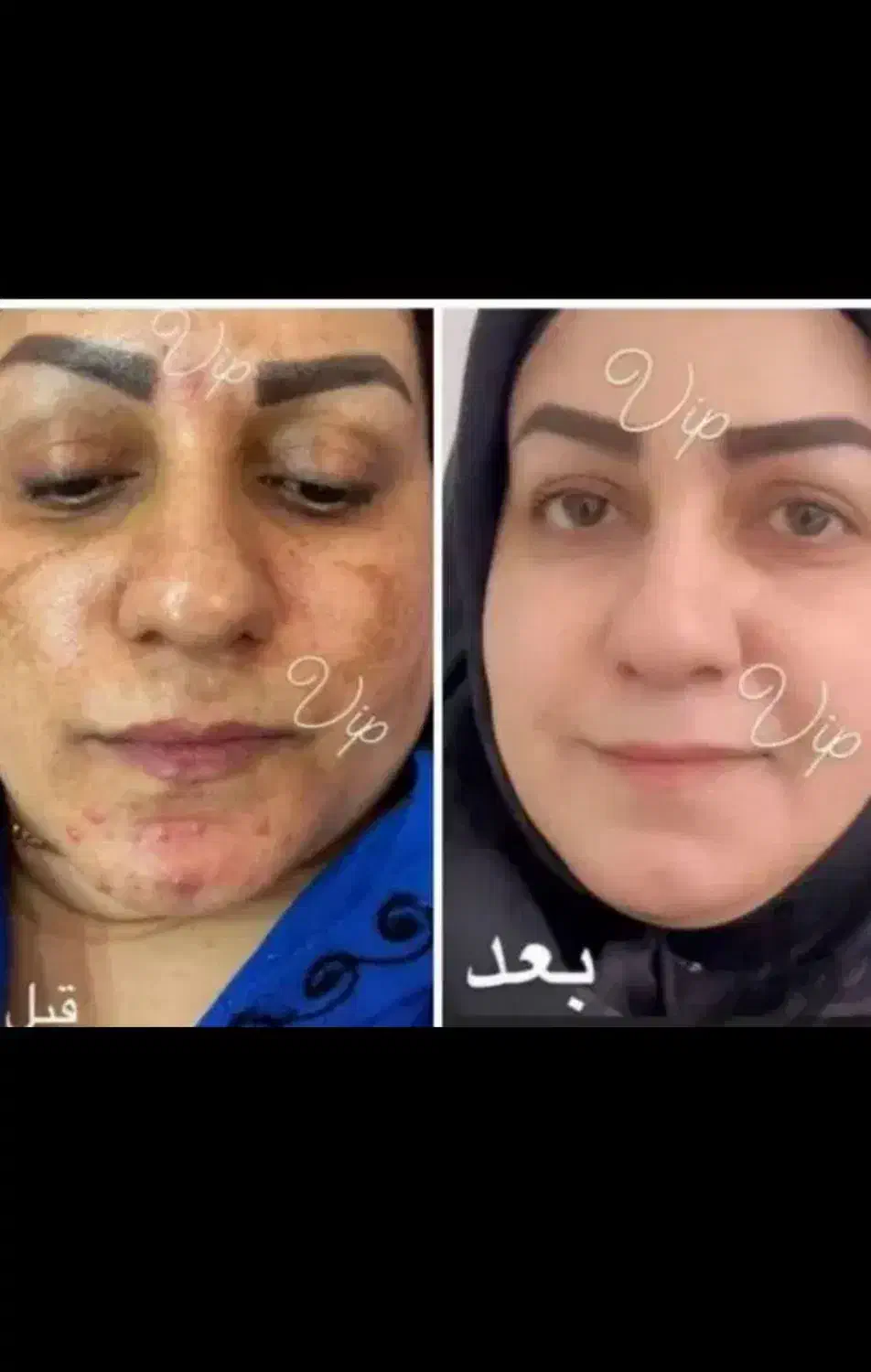 کرم سفید کننده و ضد لک ضد پیری رفع چروک جوش پوست|آرایشی، بهداشتی، درمانی|تهران, کامرانیه|دیوار