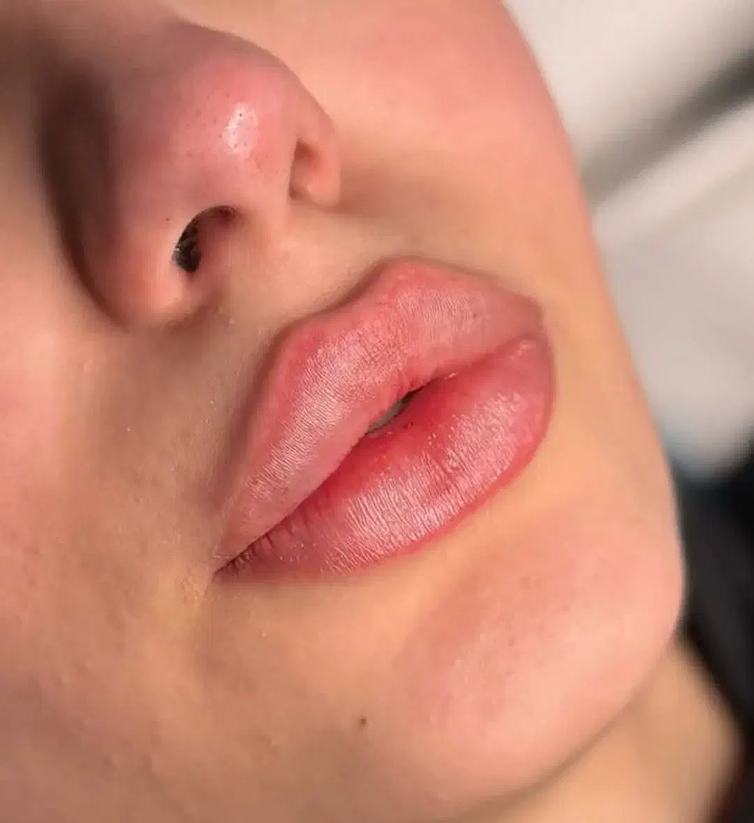 ژل ،بوتاکس،آنزیم فقط ۴۹۰ هزارتومان|خدمات آرایشگری و زیبایی|قرچک, مهدیه|دیوار