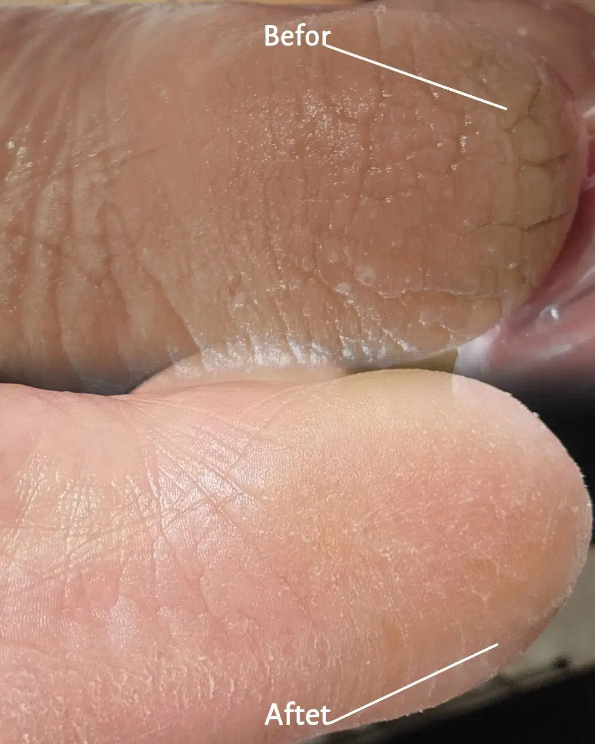 پدیکور و کف سابی پا|خدمات آرایشگری و زیبایی|شهرکرد, |دیوار