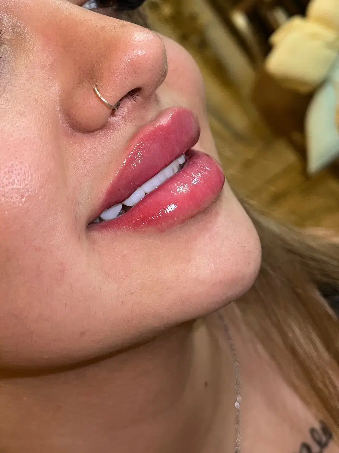 تزریق ژل و بوتاکس فقط۷۵۰|خدمات آرایشگری و زیبایی|هشتگرد, شهرک راه آهن|دیوار