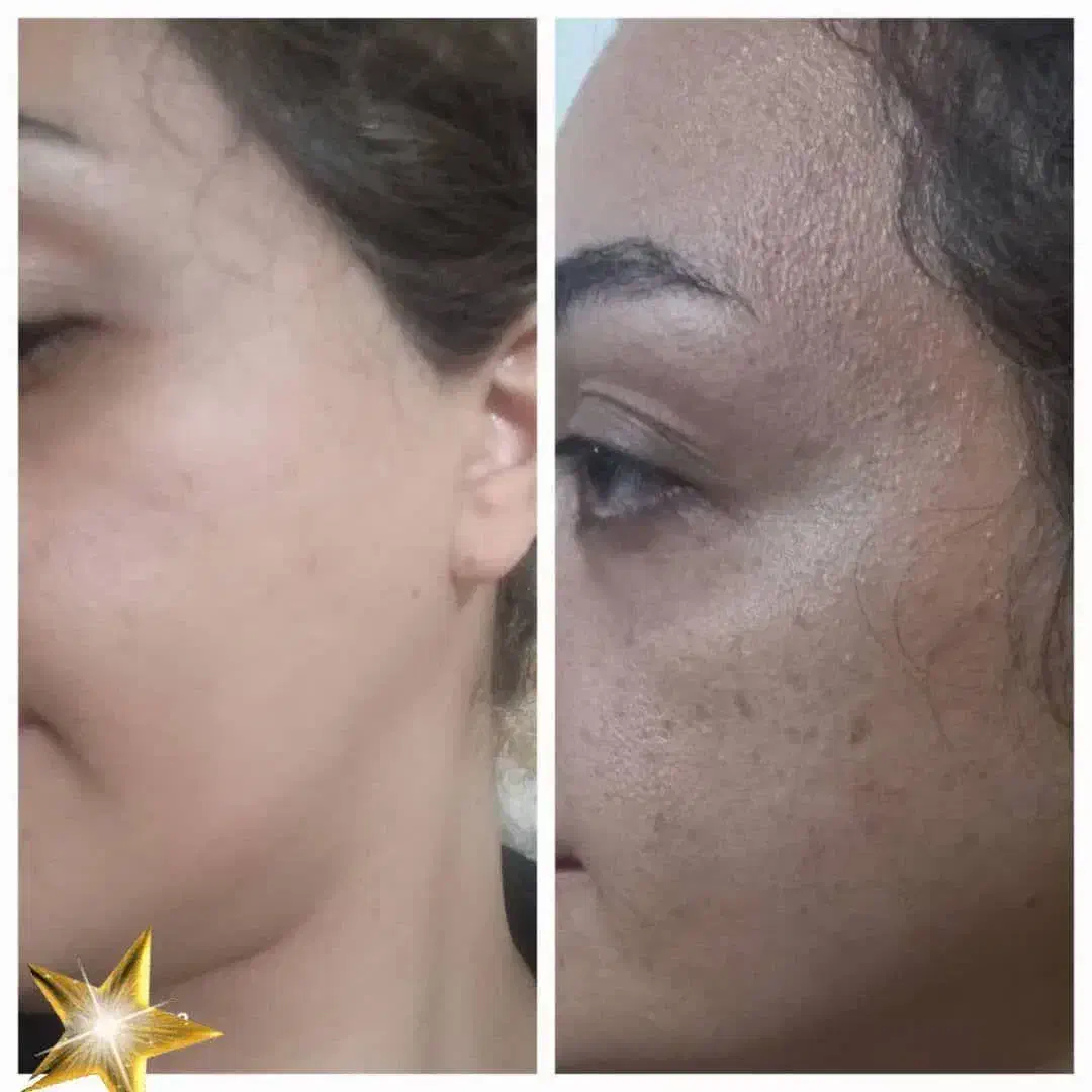 فرمول کرم وی ای پی سفیدکننده قوی صورت ودستوپا|آرایشی، بهداشتی، درمانی|میناب, |دیوار