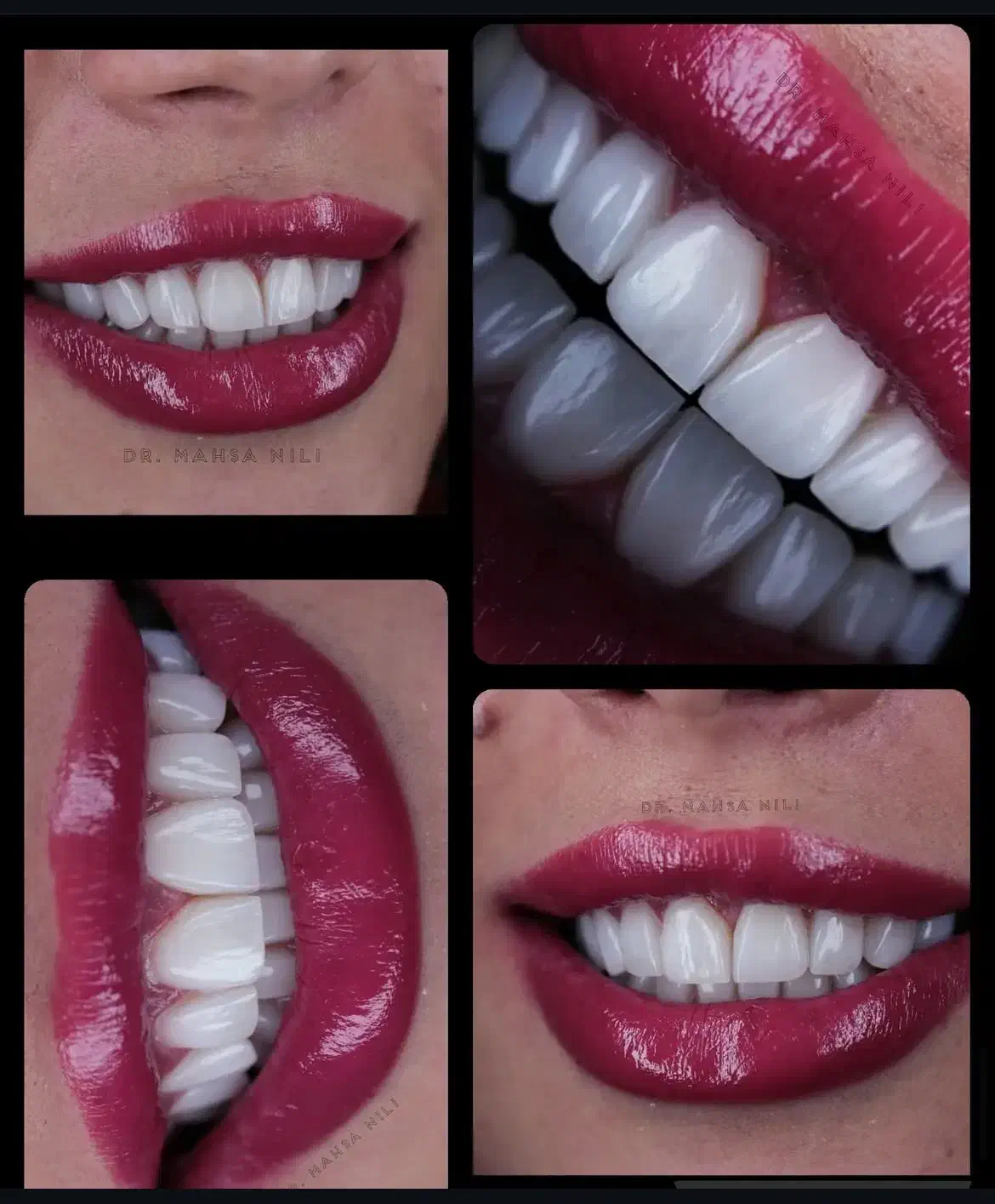 مرکزتخصصی ایمپلنت بدون دردو خونریزی/وام قرض الحسنه|خدمات آرایشگری و زیبایی|اصفهان, ملک|دیوار