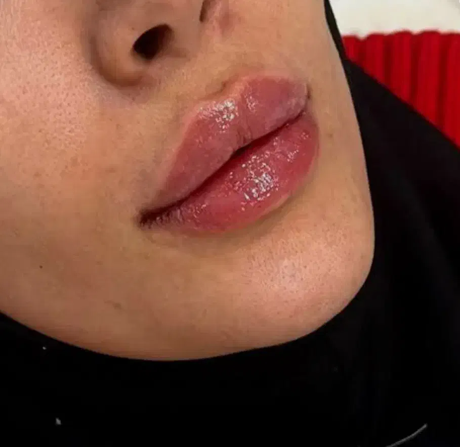 ژل بوتاکس|خدمات آرایشگری و زیبایی|جیرفت, |دیوار