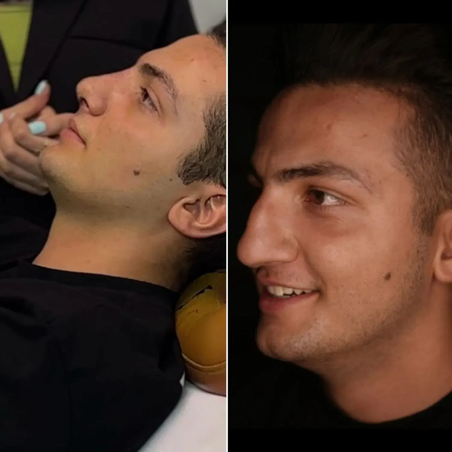 عمل بینی فقط با 30 ملیون|خدمات آرایشگری و زیبایی|شیراز, قصرالدشت|دیوار