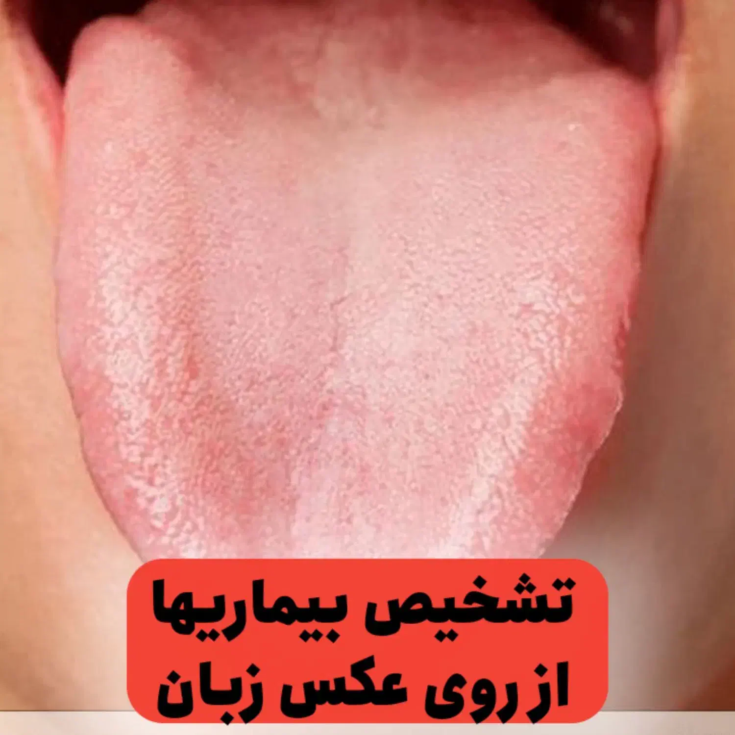 تشخیص بیماری ها با اسکن زبان شما|فعالیت داوطلبانه|خمینی‌شهر, |دیوار