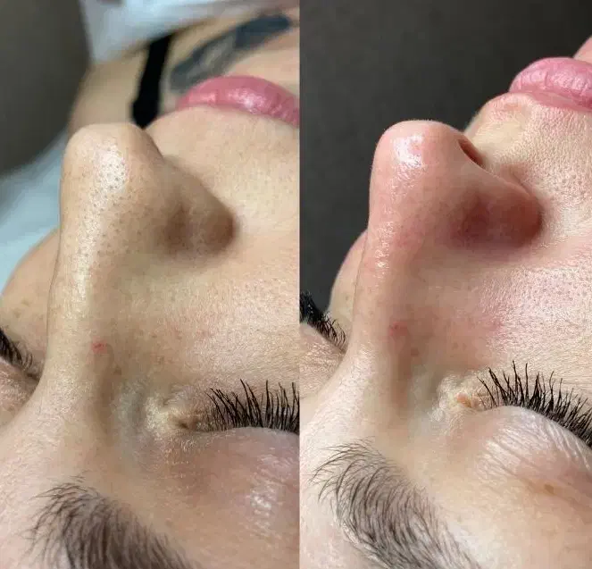 تخفیف ویژه پاکسازی پوست|خدمات آرایشگری و زیبایی|فولادشهر, C4|دیوار