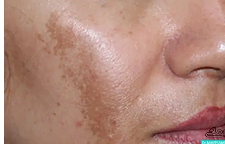 لک صورت راهنمایی .. ملاسما|فعالیت داوطلبانه تحقیقاتی|تهران, جنت‌آباد جنوبی|دیوار