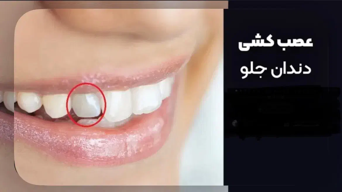 دندان|پزشکی|بندر انزلی, سی متری|دیوار