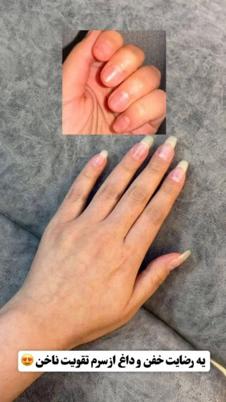 سرم دوفاز ناخن ویتابلا|آرایشی، بهداشتی، درمانی|دهلران, |دیوار