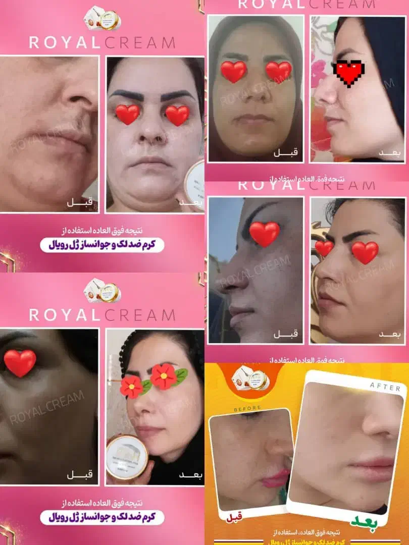 پنکک لاکچری کوین اصل|آرایشی، بهداشتی، درمانی|دورود, |دیوار