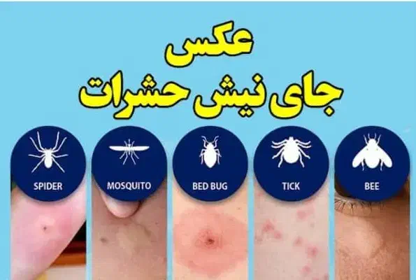 سمپاشی عقرب|خدمات نظافت|کیش, |دیوار