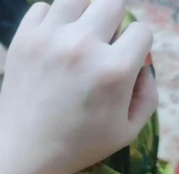 سفید کننده ضدلک اصل تضمینی حاوی گلوتاتیون بشدت قوی|آرایشی، بهداشتی، درمانی|بم, |دیوار