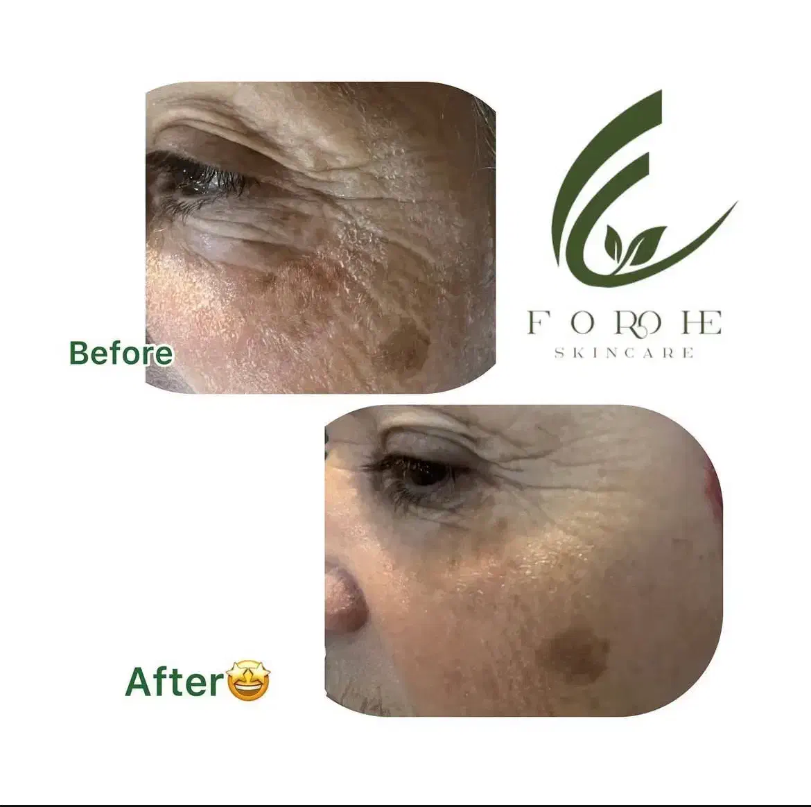 تخفیف ویژه یلدا و روز مادر فیشال تخصصی پوست|خدمات آرایشگری و زیبایی|مشهد, هفت تیر (آب و برق)|دیوار