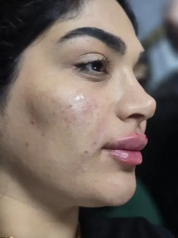 مدل ژل لب وبوتاکس فیلروغیره|خدمات آرایشگری و زیبایی|اسلام‌شهر, شهرک توحید|دیوار