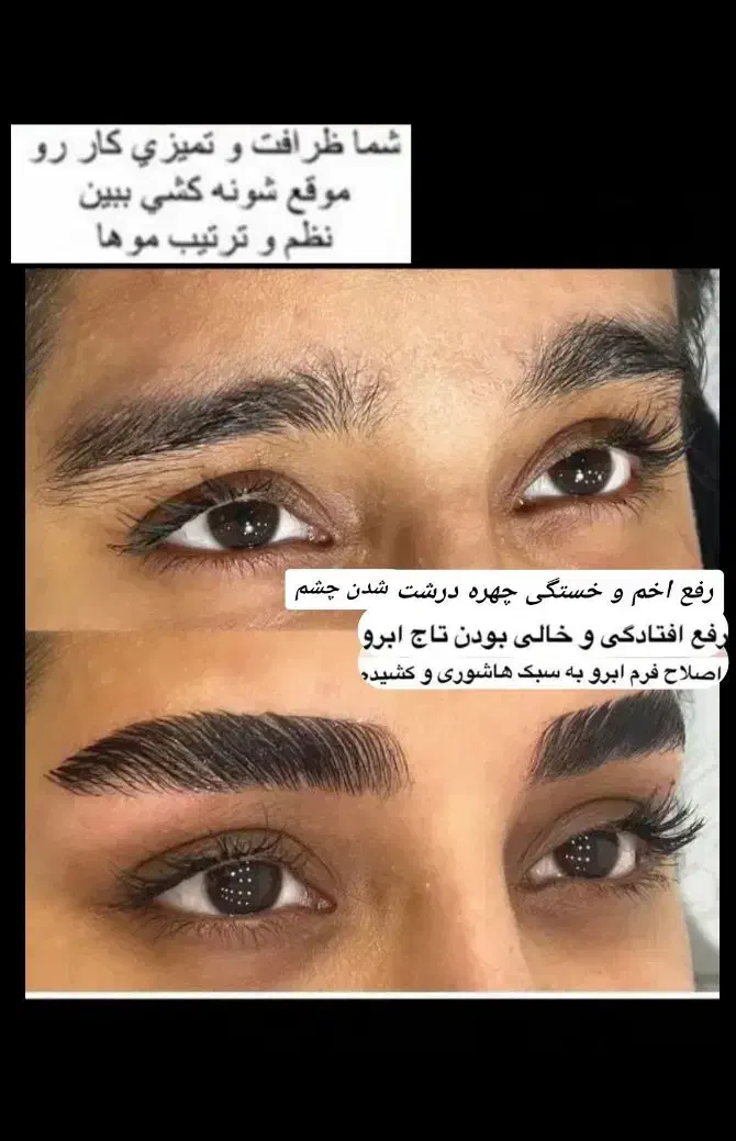 شاداب کردن چهره شما تخصص ماست تقویت کننده ابرو|آرایشی، بهداشتی، درمانی|قم, باجک دو|دیوار