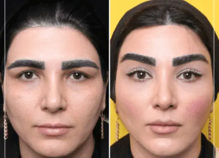 خدمات زیبایی و جوانسازی|خدمات آرایشگری و زیبایی|کرمانشاه, |دیوار