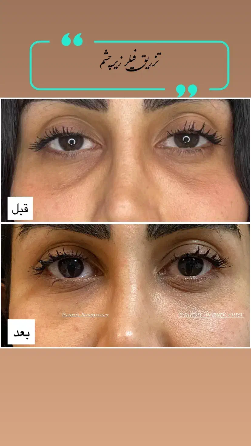 کلینیک پوست ، مو و لیزر|خدمات آرایشگری و زیبایی|شهریار, شهریار|دیوار