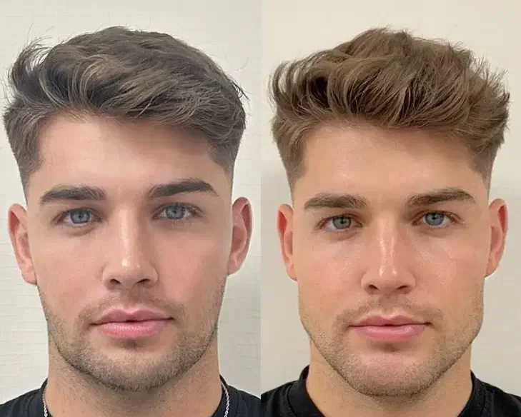 ویژه اقایان آف بوتاکس فیلر و پاکسازی|خدمات آرایشگری و زیبایی|کرج, گلشهر|دیوار