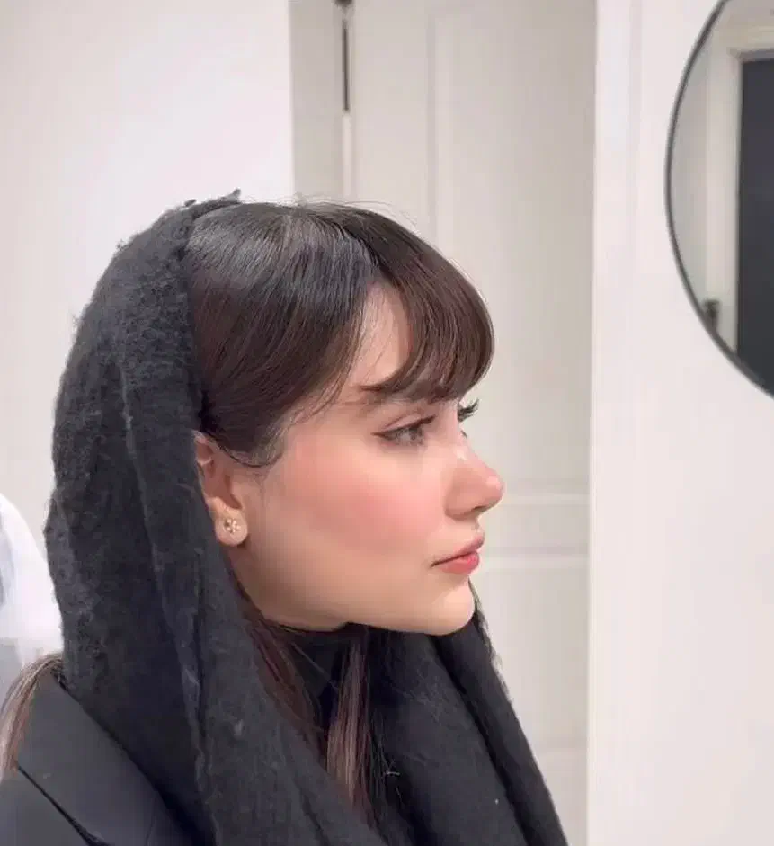 عمل بینی،لیفت لیپو ابدو،رفع غبغب،دایرکت ابرو،کاشت|خدمات آرایشگری و زیبایی|اسلامشهر, شهرک مهدیه|دیوار