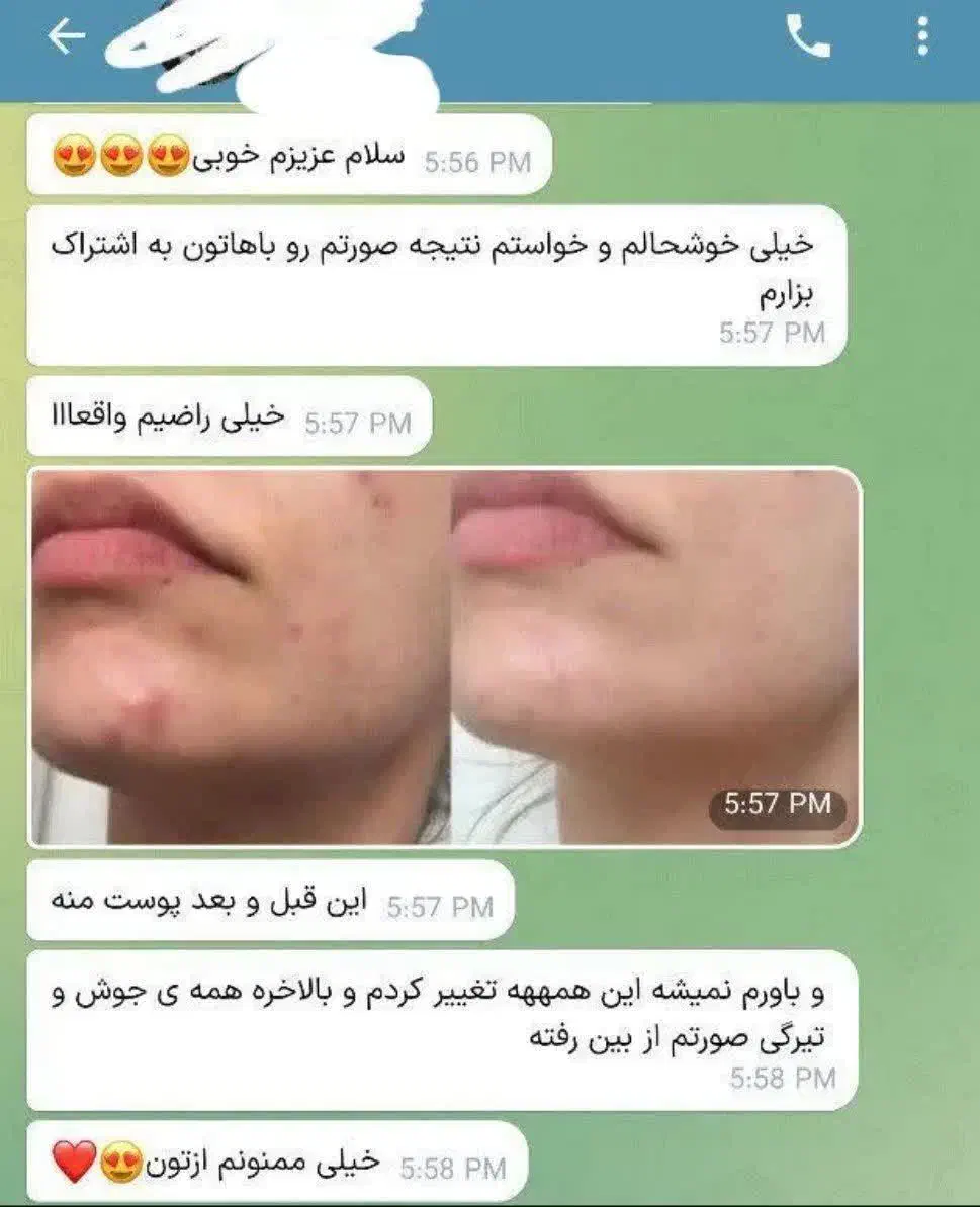 محصولات آرایشی و بهداشتی تراست|آرایشی، بهداشتی، درمانی|مسجد سلیمان, |دیوار