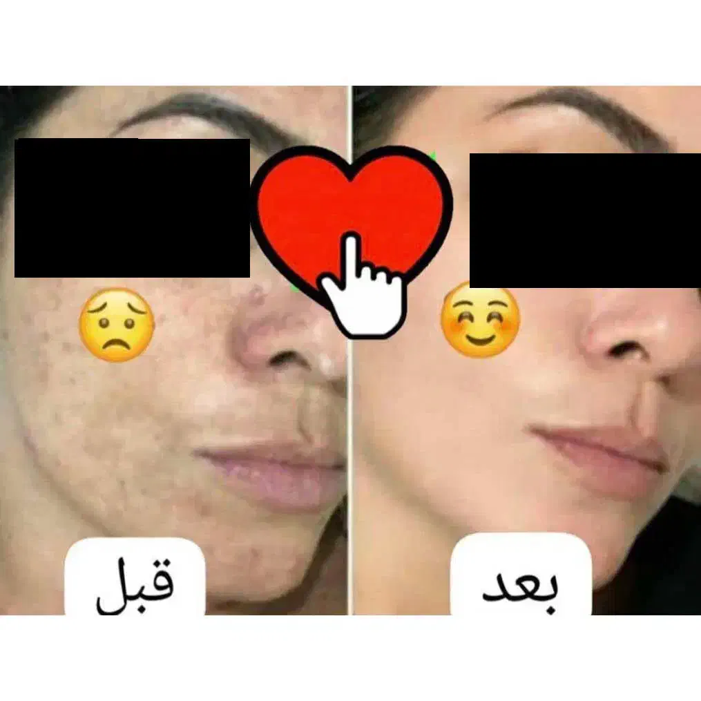 فرمول کرم سفید کننده صورت ودست پا|آرایشی، بهداشتی، درمانی|زاهدان, |دیوار