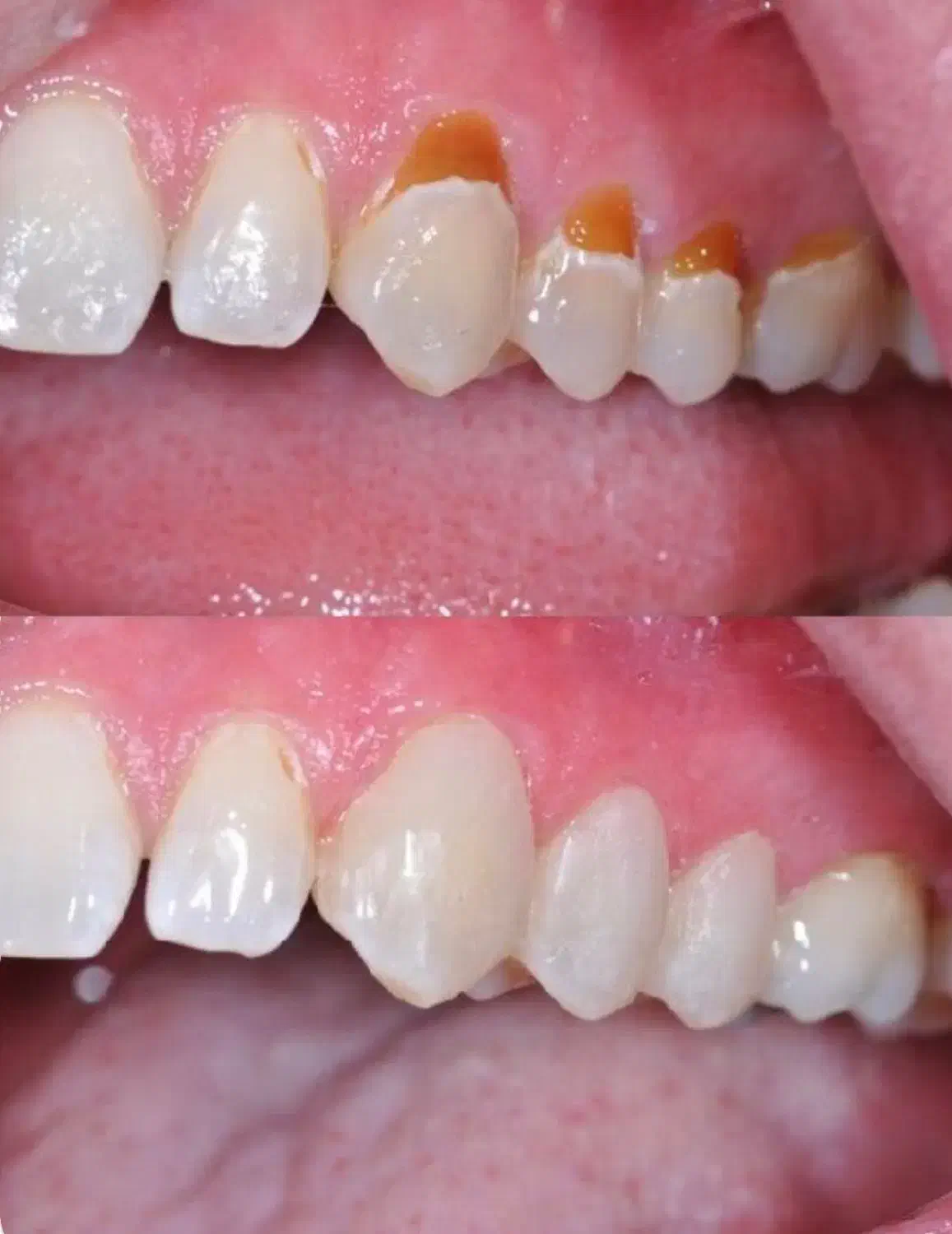 جشنواره یلدایی خدمات دندانپزشکی|خدمات آرایشگری و زیبایی|اردبیل, |دیوار