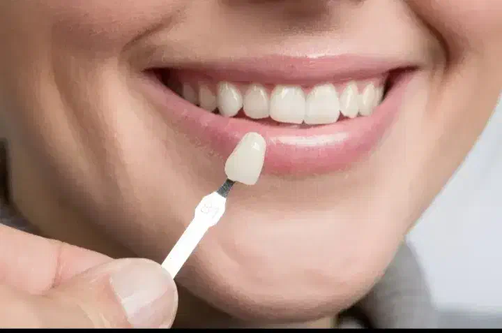 پایینترین قیمت دندانپزشکی در استان|خدمات آرایشگری و زیبایی|یاسوج, |دیوار