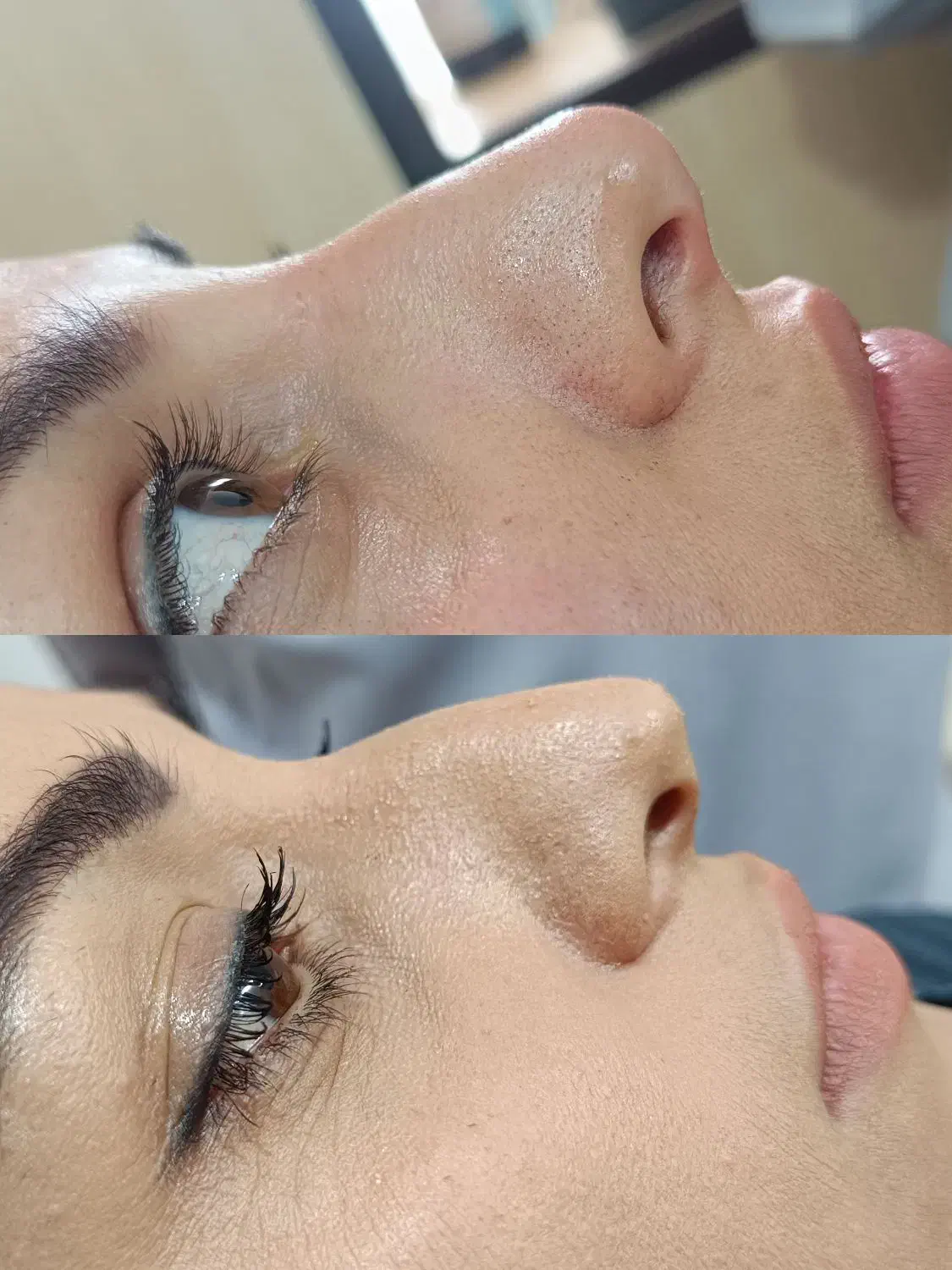 تزریقات زیبایی|خدمات آرایشگری و زیبایی|قرچک, مهدیه|دیوار