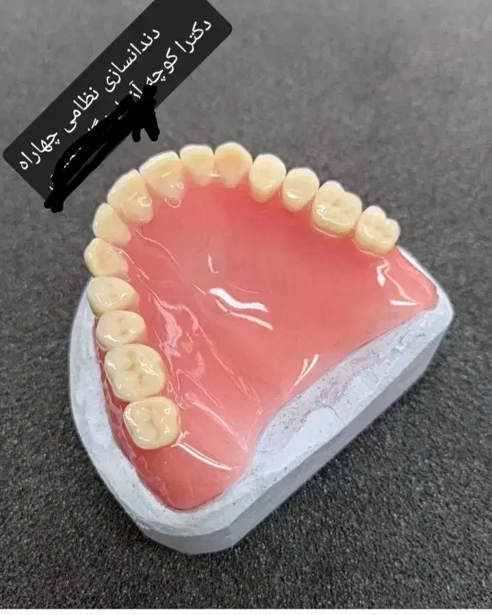 ساخت دندان مصنوعی سرامیکی دریک روز|آرایشی، بهداشتی، درمانی|زابل, |دیوار