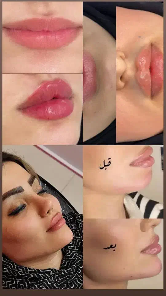 خدمات زیبایی|خدمات آرایشگری و زیبایی|اهواز, کوی ملی راه|دیوار