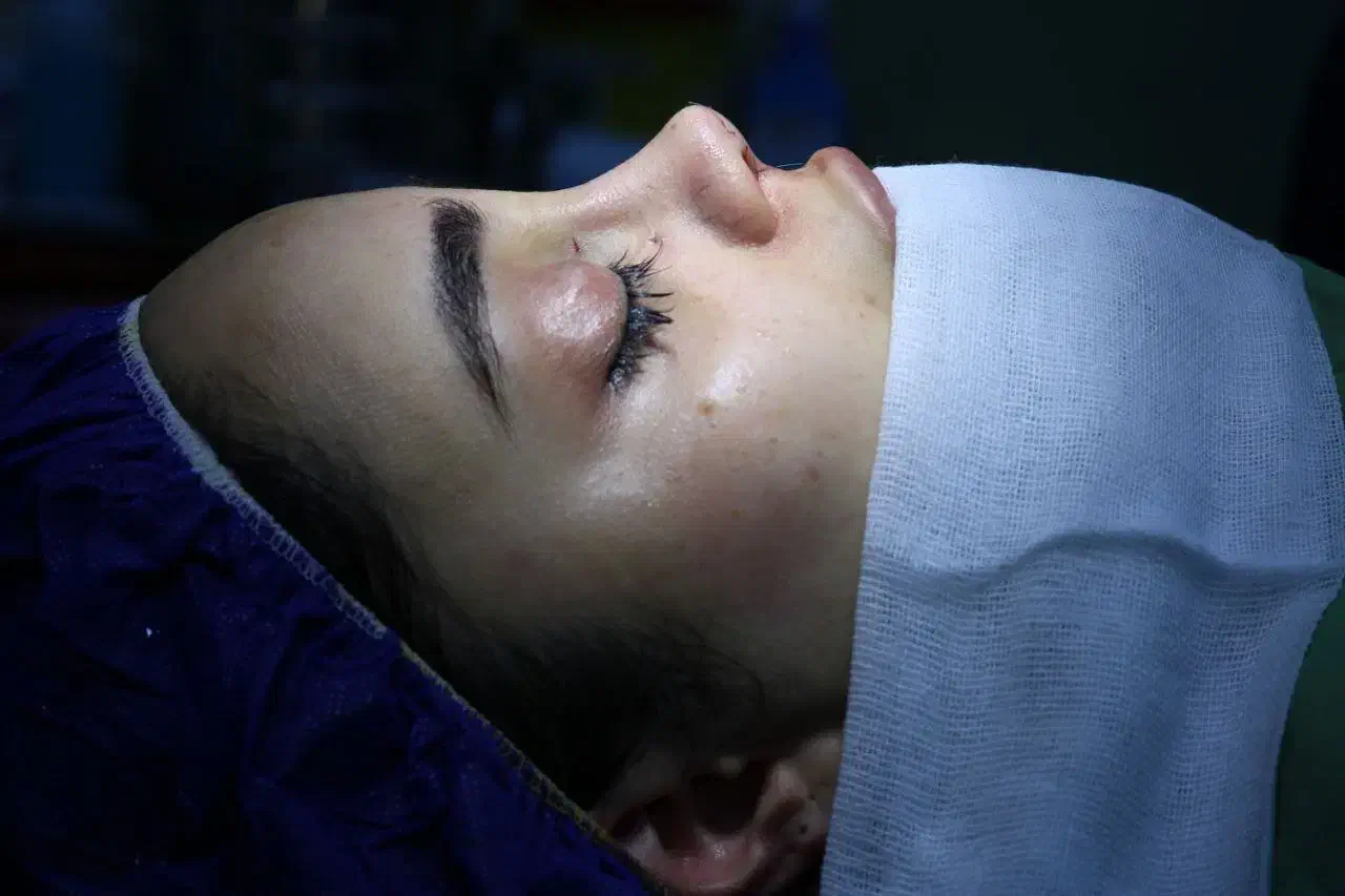 عمل بینی متخصص گوش حلق بینی، اقساطی|خدمات آرایشگری و زیبایی|تهران, قلهک|دیوار