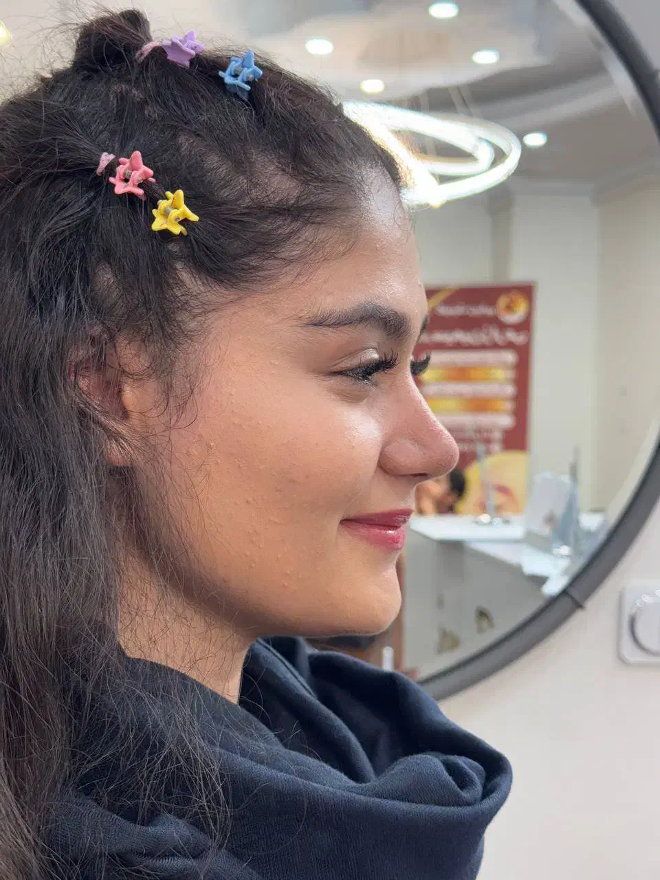 10 میلیون تخفیف عمل جراحی بینی بدون تامپون،لیفت|خدمات آرایشگری و زیبایی|فردیس, طالقانی|دیوار