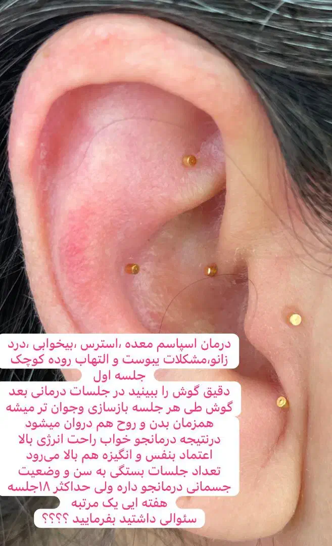 لاغری تضمینی با ای اس پی|آرایشی، بهداشتی، درمانی|کرمان, |دیوار