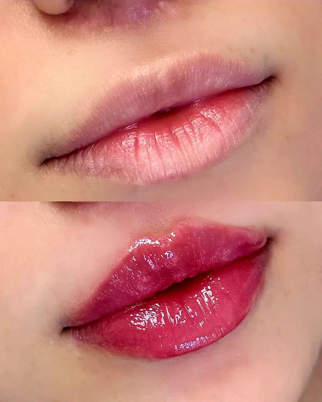 جذب مدل ژل صورت مخصوص فرمدهی و جوانسازی|خدمات آرایشگری و زیبایی|اندیمشک, |دیوار