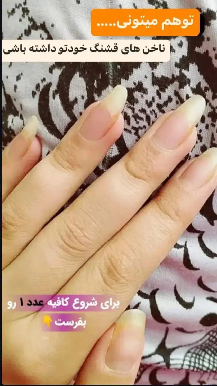 محلول تقویت ناخن|آرایشی، بهداشتی، درمانی|بناب, |دیوار