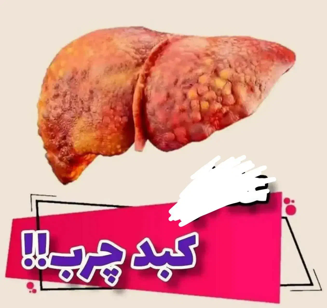 اگردوستداری بچه دار بشی ویا کبد چرب وتیروئیدو...|خدمات آرایشگری و زیبایی|خورموج, |دیوار