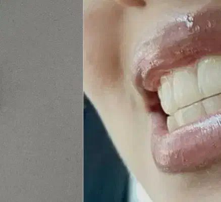 درمان کیست دندون میخواستم|فعالیت داوطلبانه تحقیقاتی|اردبیل, |دیوار