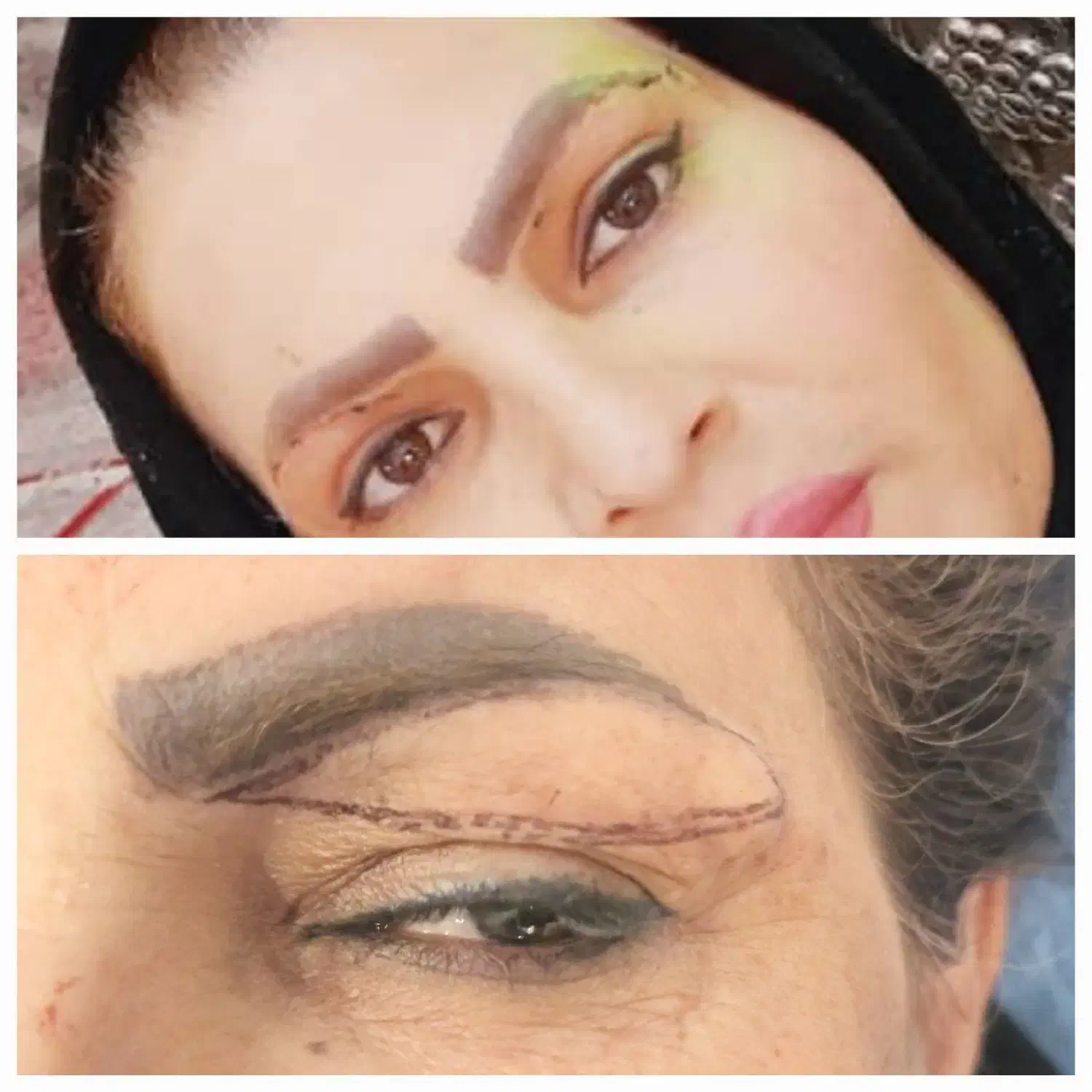 ژل بوتاکس بلفارو پلاستی لیزر|خدمات آرایشگری و زیبایی|اهواز, اهواز|دیوار