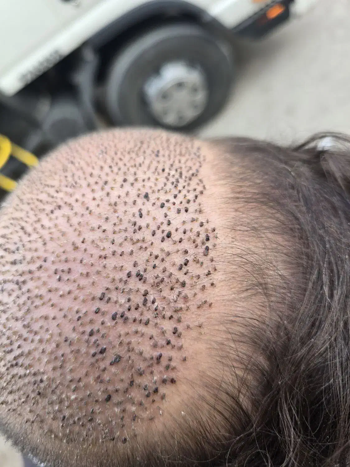 استخدام خانم  برداشت کار|استخدام درمانی، زیبایی، بهداشتی|اهواز, کیانپارس |دیوار