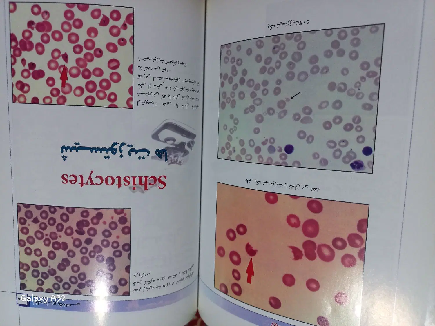 اطلس خون شناسی Hematology|کتاب و مجله آموزشی|تهران, جمالزاده|دیوار