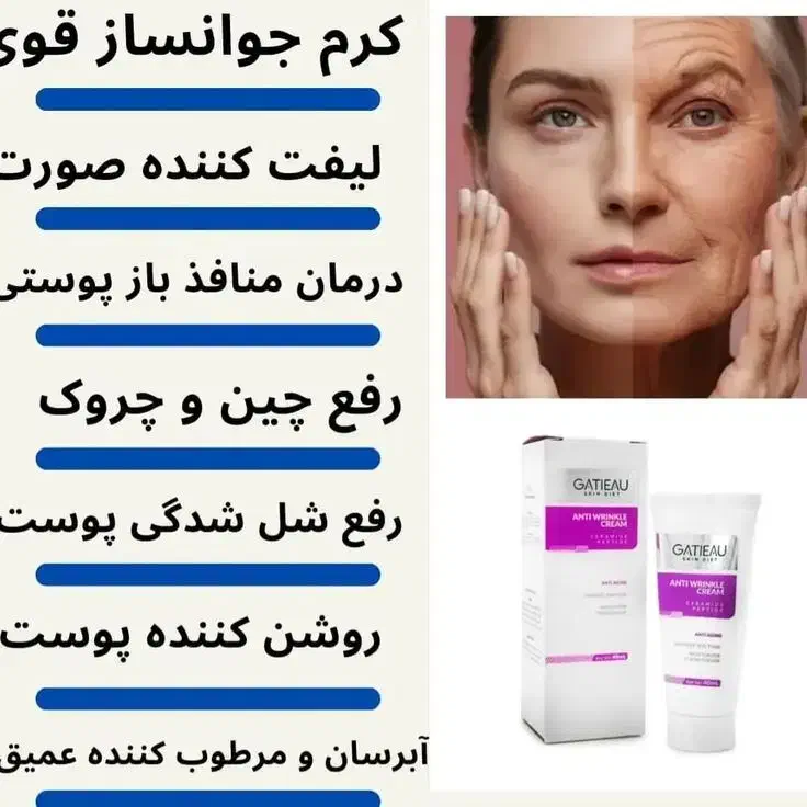 کرم بوتاکس پنج کاره ایتالیایی گاتیو|آرایشی، بهداشتی، درمانی|فولادشهر, فولادشهر|دیوار