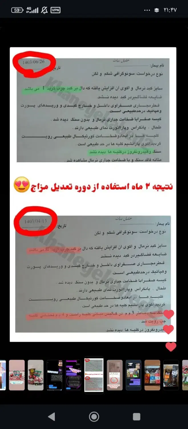 درمان قطعی چربی خون و فششارخون گیاهی|خوردنی و آشامیدنی|اردکان, |دیوار