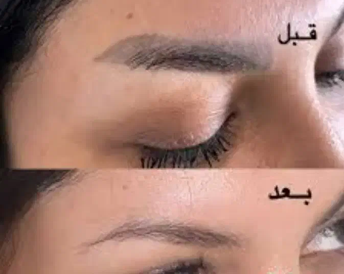 اولین مرکز لیزر با دو مدل دستگاه لیزر شاتی و رولی|خدمات آرایشگری و زیبایی|نجف‌آباد, باغ ملی|دیوار
