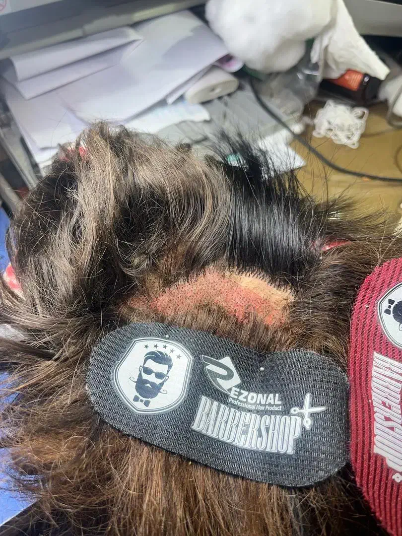 ترمیم. ریختگی موی پروتز و پارگی پوستیژ|خدمات آرایشگری و زیبایی|تبریز, |دیوار