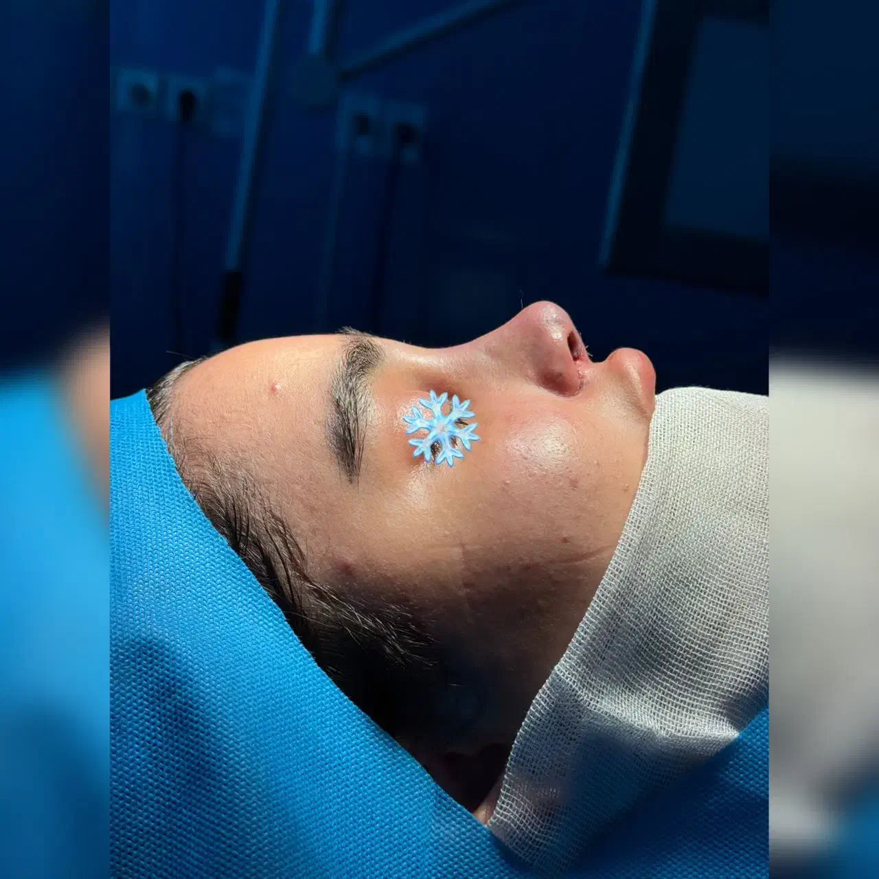 عمل بینی ۳۰ م /متخصص گوش و حلق و بینی|خدمات آرایشگری و زیبایی|تهران, میدان ولیعصر|دیوار