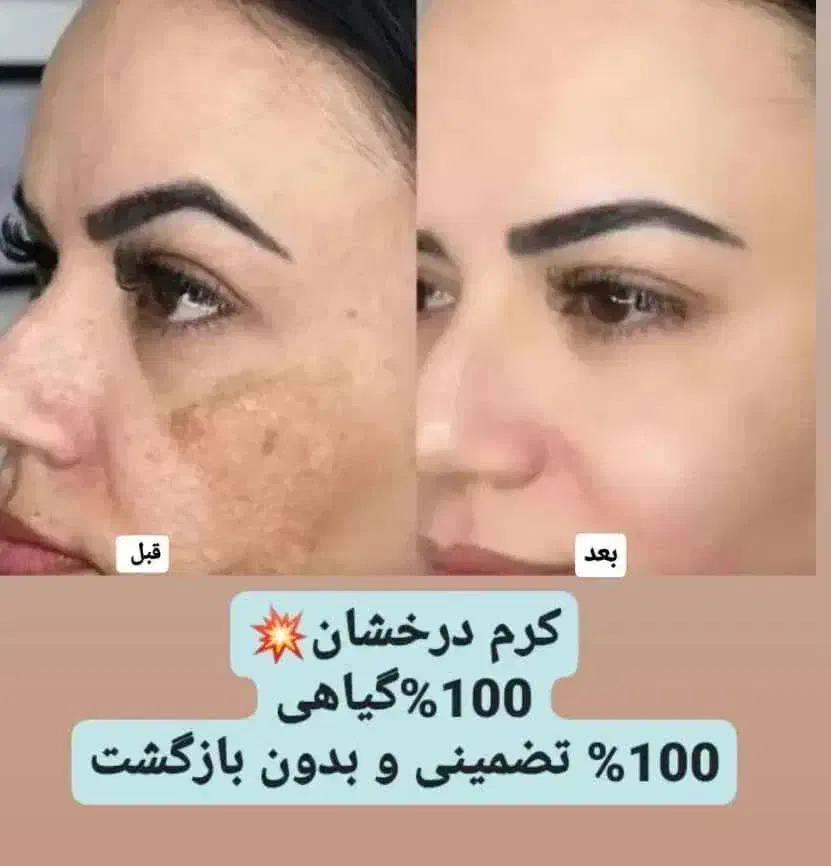 کرم چند کاره درخشان کاملا انحصاری و بدون بازگشت|حراج|خرمآباد, |دیوار