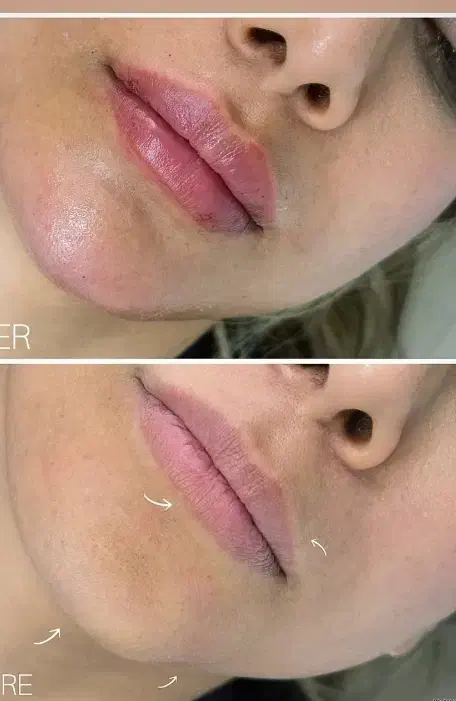 لیزر موهای زائد بدن و فشیال و پاکسازی صورت|خدمات آرایشگری و زیبایی|اسلام‌شهر, شهرک سعیدیه|دیوار