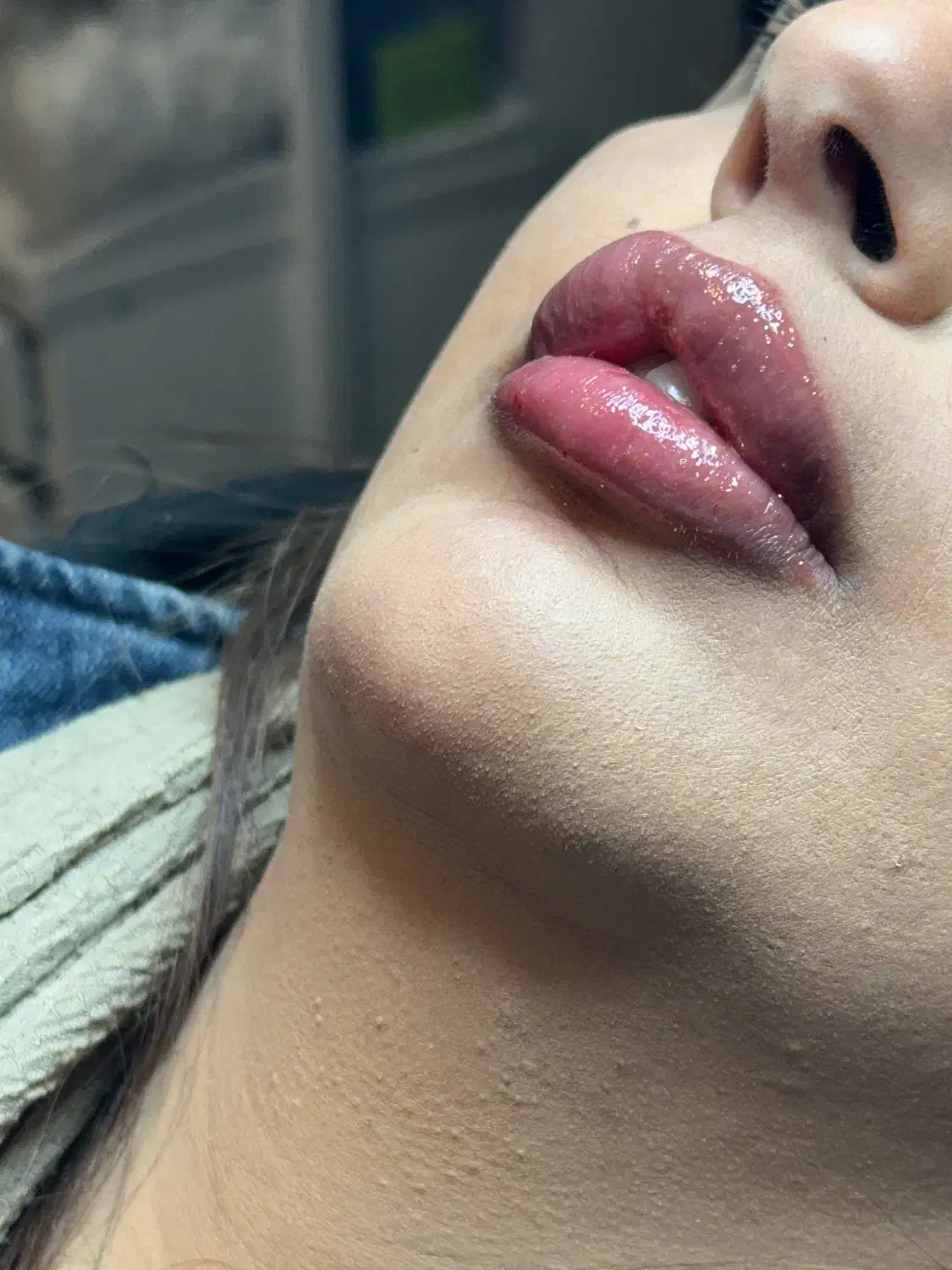 تزریق ژل لب وکانتورینگ(+بوتاکس رایگان|خدمات آرایشگری و زیبایی|کرمانشاه, |دیوار